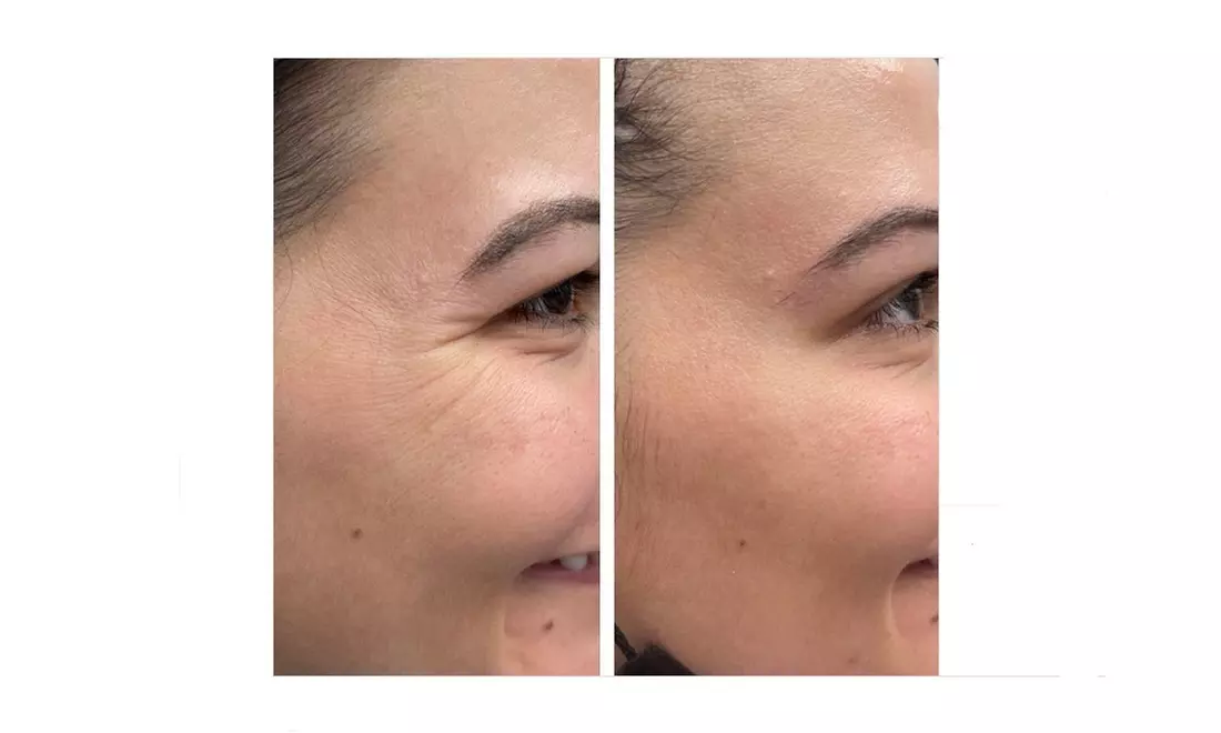 revive-faces-indir-full-v2-0-17-galeri-1-b576.jpg